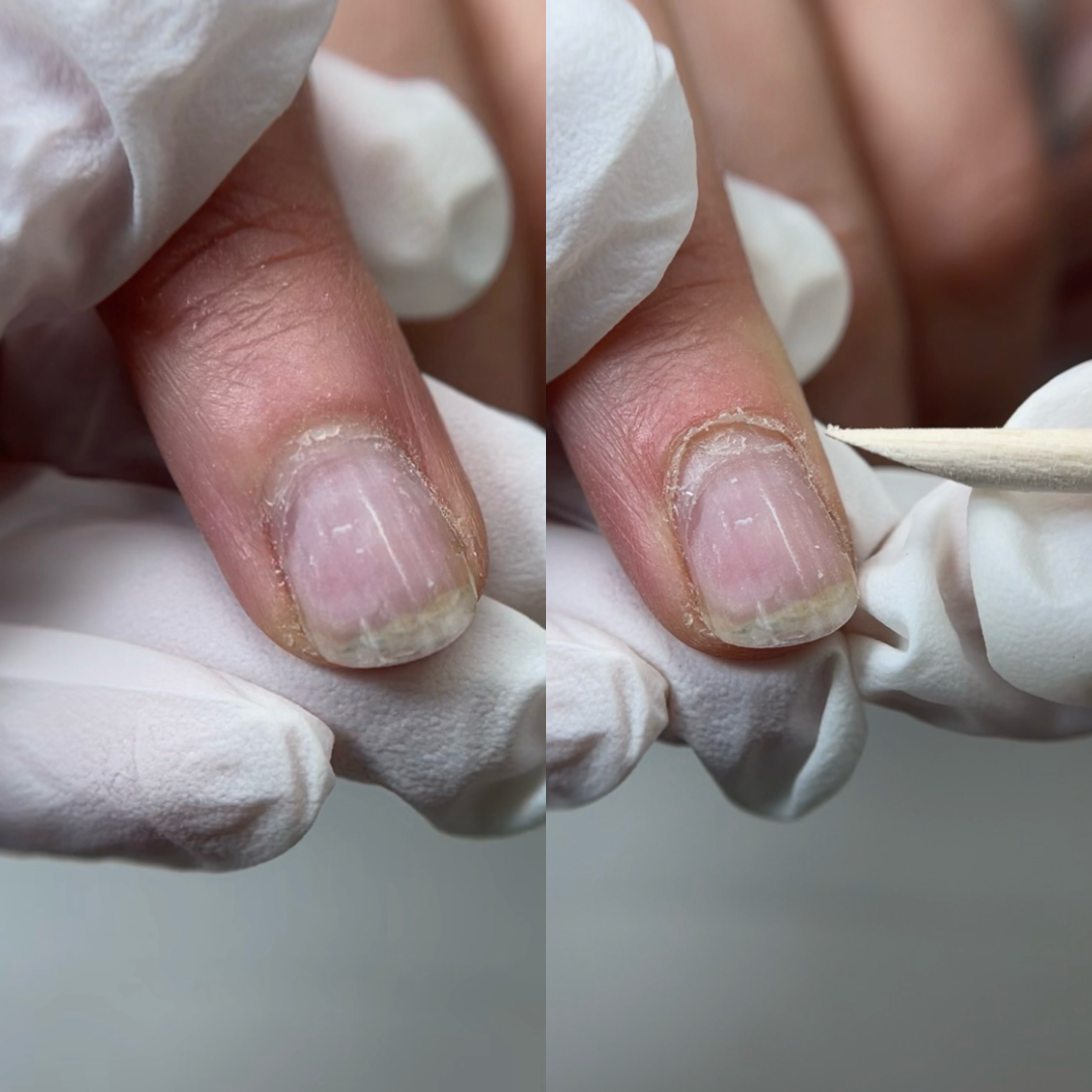 Free Lesson: How to Form a Safe Cuticle Pocket